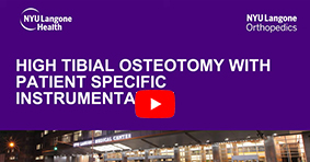 High Tibial Osteotomy with Patient Specific Instrumentation