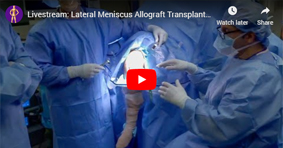Livestream: Lateral Meniscus Allograft Transplantation