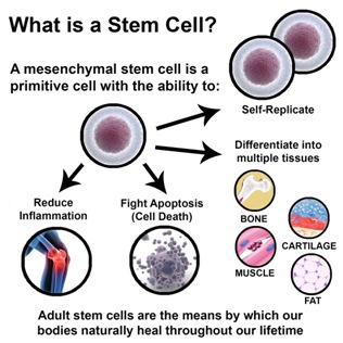 WHAT IS A STEM CELL PROCEDURE?